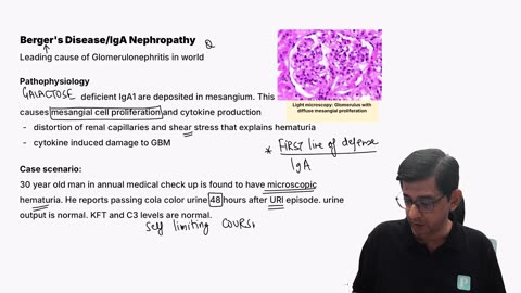 58 - Nephrotic and nephritic syndrome