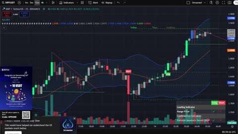 🔴 LIVE XRP Chart Stream Party | AI Trading Signals 🔴