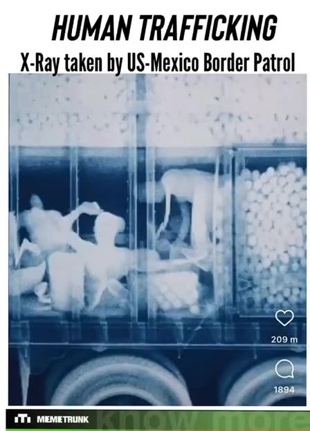 Human Trafficking X-Ray taken by US Mexican Border Patrol.
