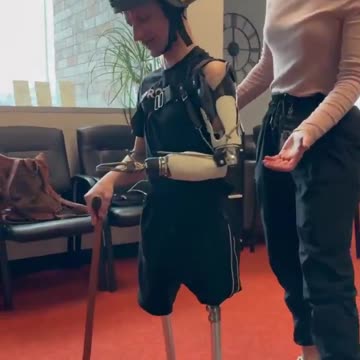 Will They Get the Gun? 😱 Key Focus: Longer Prosthetics Needed