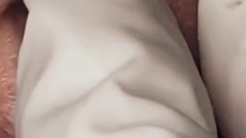 Blackheads on the nose extraction (ASMR) #1 #shorts