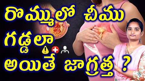 రొమ్ములో చీము గడ్డలా జాగ్రత్త Be Careful If You Have A Pus Lump In The Breast Abcess Homeopathy Cure