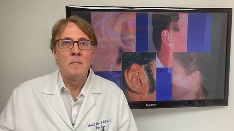 Facelift Incisions Around the Ears