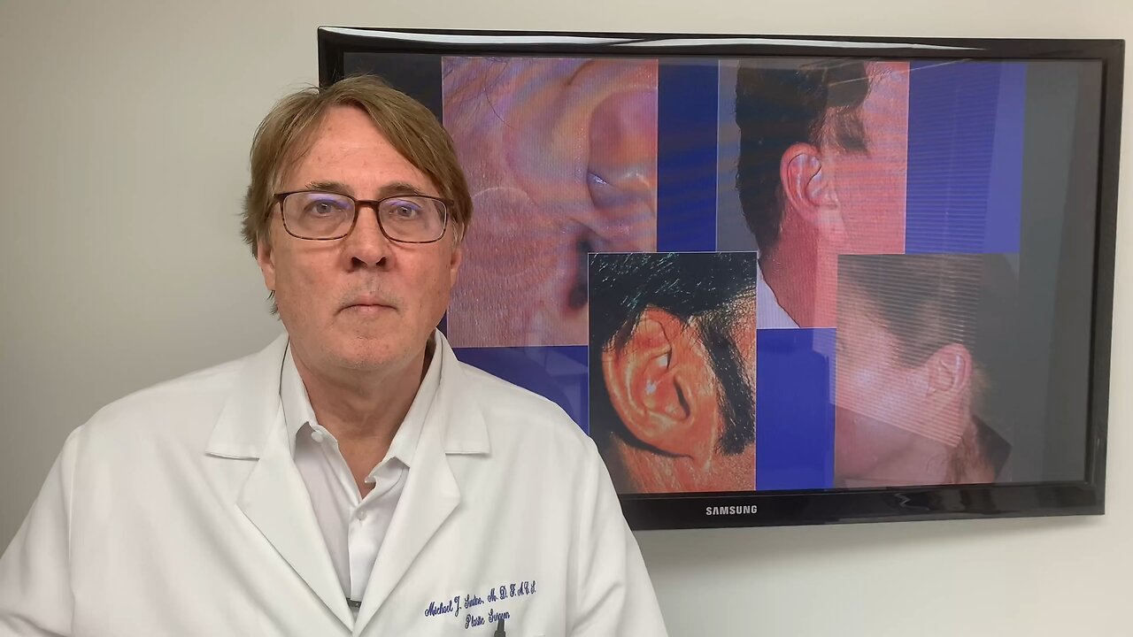 Facelift Incisions Around the Ears