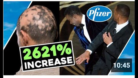 "Pfizer Stunt Results in 2621% Increase in Hair Loss"