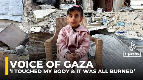 Gaza girl orphaned in Israeli strike rebuilds her life with severe burns
