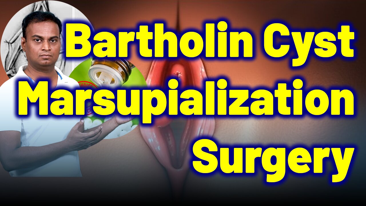 Patients Avoid Marsupialization with Homeopathy for Bartholin Cyst,Abscesses |Treatment & Cure|