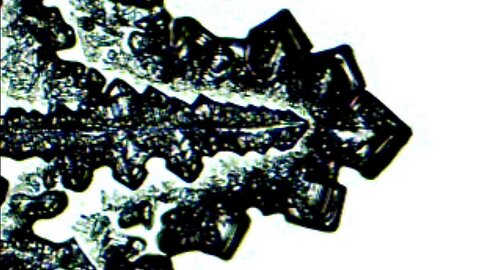 Microscopic analysis mixing blood with saline creates crystals explosion under microscope pt2