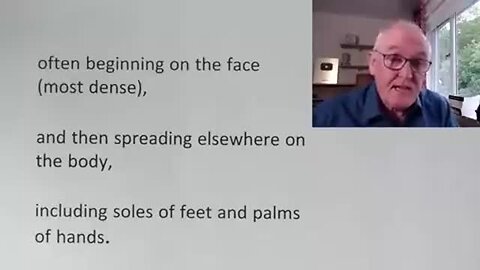 "Explore More About Monkeypox"