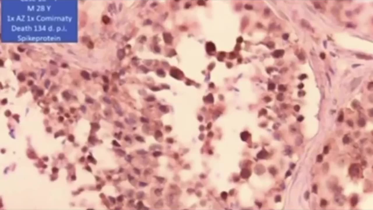 GERMAN PROFESSOR KILLED IN "ACCIDENT" AFTER SHARING HIS FINDINGS OF HIS RESEARCH