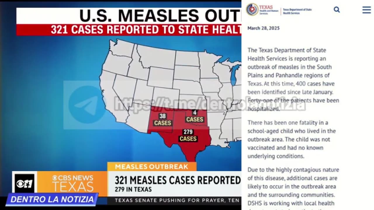 Campagna di vaccinazione contro il morbillo nel Texas