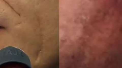 Andre the giant is alive!?!?!?