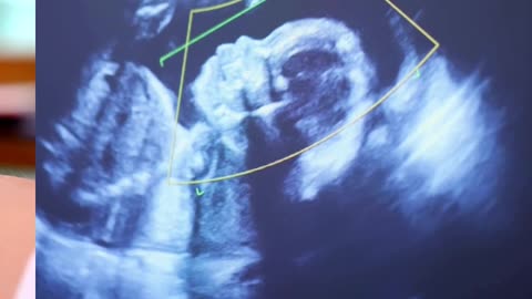 Pioneering IVF & Fertility Treatments at Sumathi Hospital, Madurai