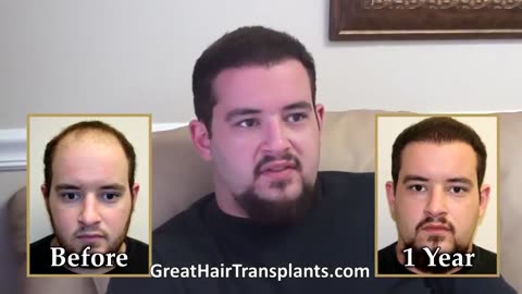 Top Hair Transplant Clinics Recommended in Denton, Texas - promo