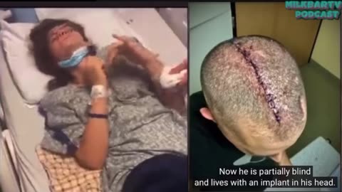 FEEL SAFE YET? Vaccine Injured: This Is What You Don't See - Vaccination For Other People - MilkBarTV