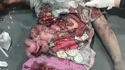 If images of torn and broken children are not enough to stop this madness (Graphic warning)