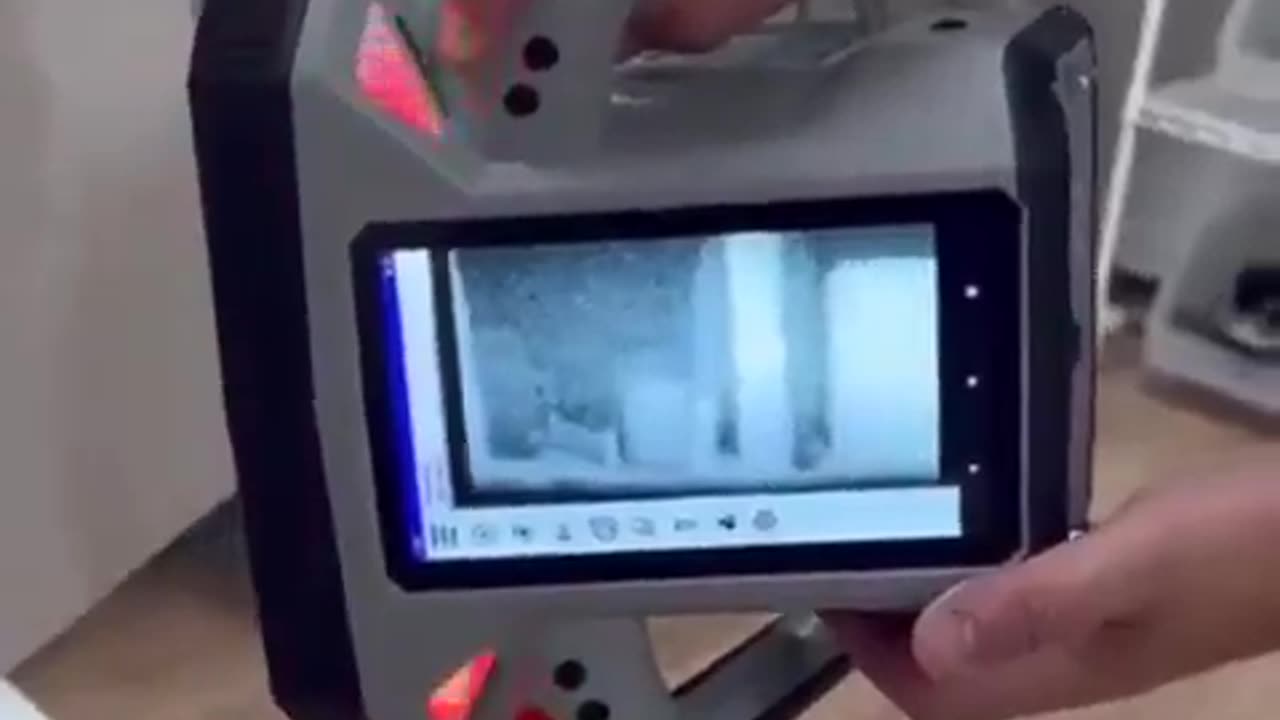 Portable X-Ray