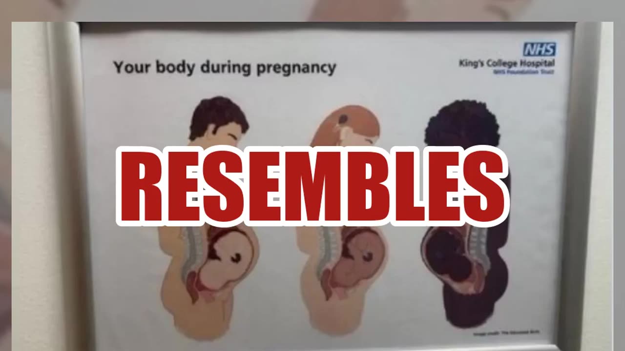 Fact Check: NHS King's College Hospital Did NOT Post An Informational Poster That Shows Pregnant Men