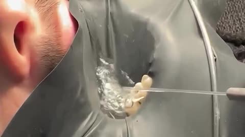 This rubber dam is actually a crucial step when it comes to dentistry!