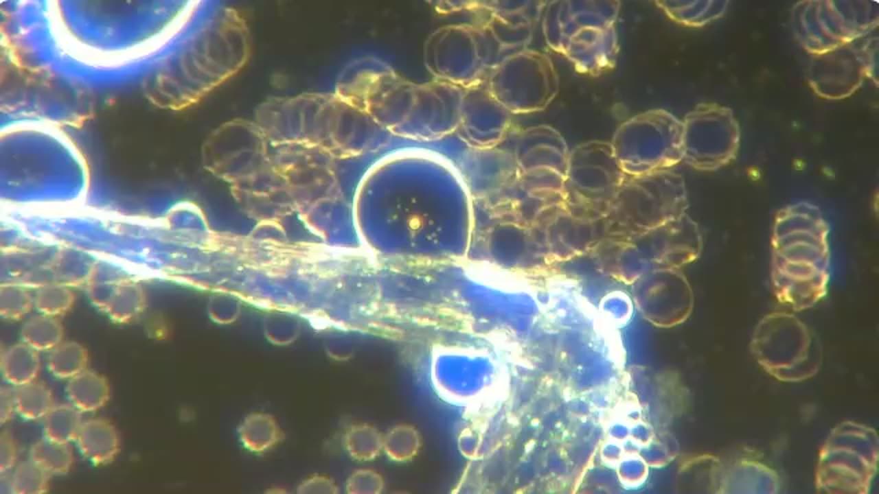 Полимерная нить, состоящая из липосом, заполненных нано- и микророботами,собирающими эритроциты