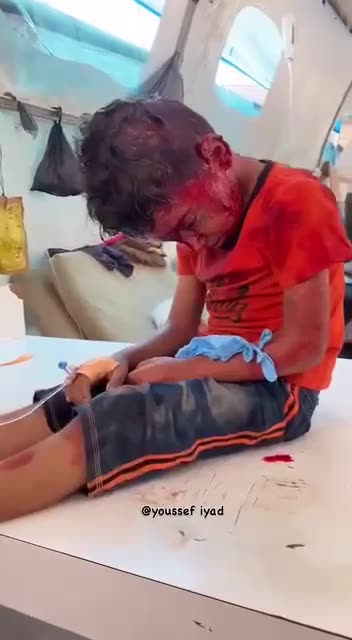 A Palestinian child was severely wounded in the Israeli massacre