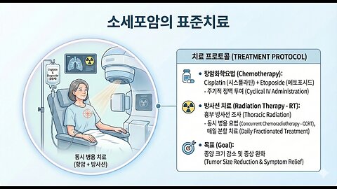 소음인에게 소음인약인 시스플라틴을 써도 토포이소머레이즈저해제 에토포시드와 같이써서 나빠진 소세포암 케이스 small cell lung cancer