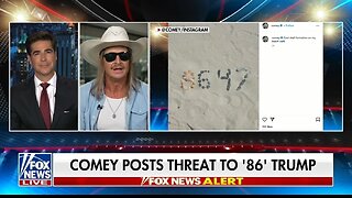 Kid Rock Goes Off On James Comey: Drunk or Crippled by TDS