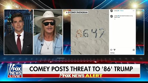 Kid Rock Goes Off On James Comey: Drunk or Crippled by TDS