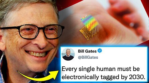 Bill Gates Boasts New Electronic Tattoo System will Eradicate Non compliance with Agenda 2030