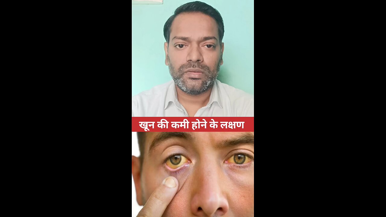 खून की कमी होने के लक्षण ।