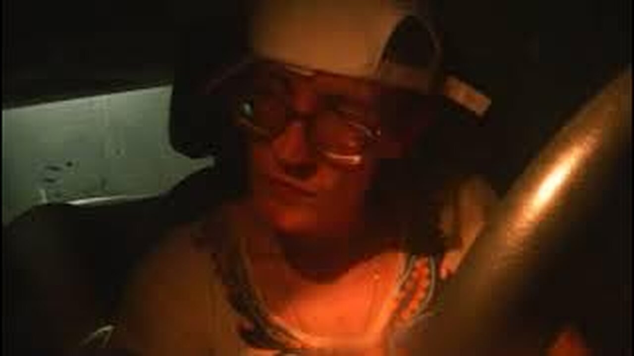 say hi to the siamese twin in my brain (male)