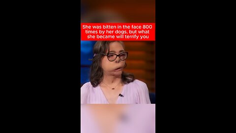 Pit Bull Attack Caught on Camera: The Jacqueline Durand Tragedy”