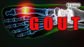 Gout 👣🦿💪🙏🏻🔥