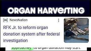 Organ Harvesting