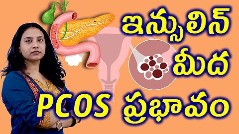 ఇన్సులిన్ మీద PCOS ప్రభావం ఎంత ఉంటుంది? How PCOS Causes Insilin Resistence? Homeopathy Treatment