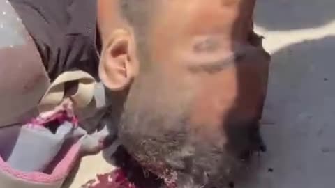 In Gaza, people are dying of oppression, hunger, and bombing