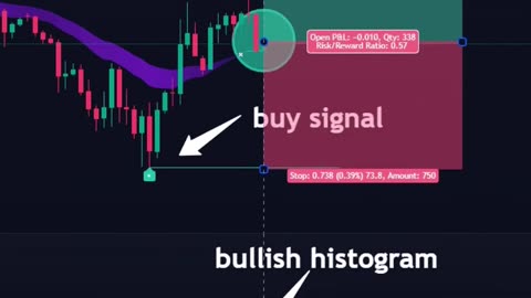 Indicators detect market trend levels🔥#daytrading