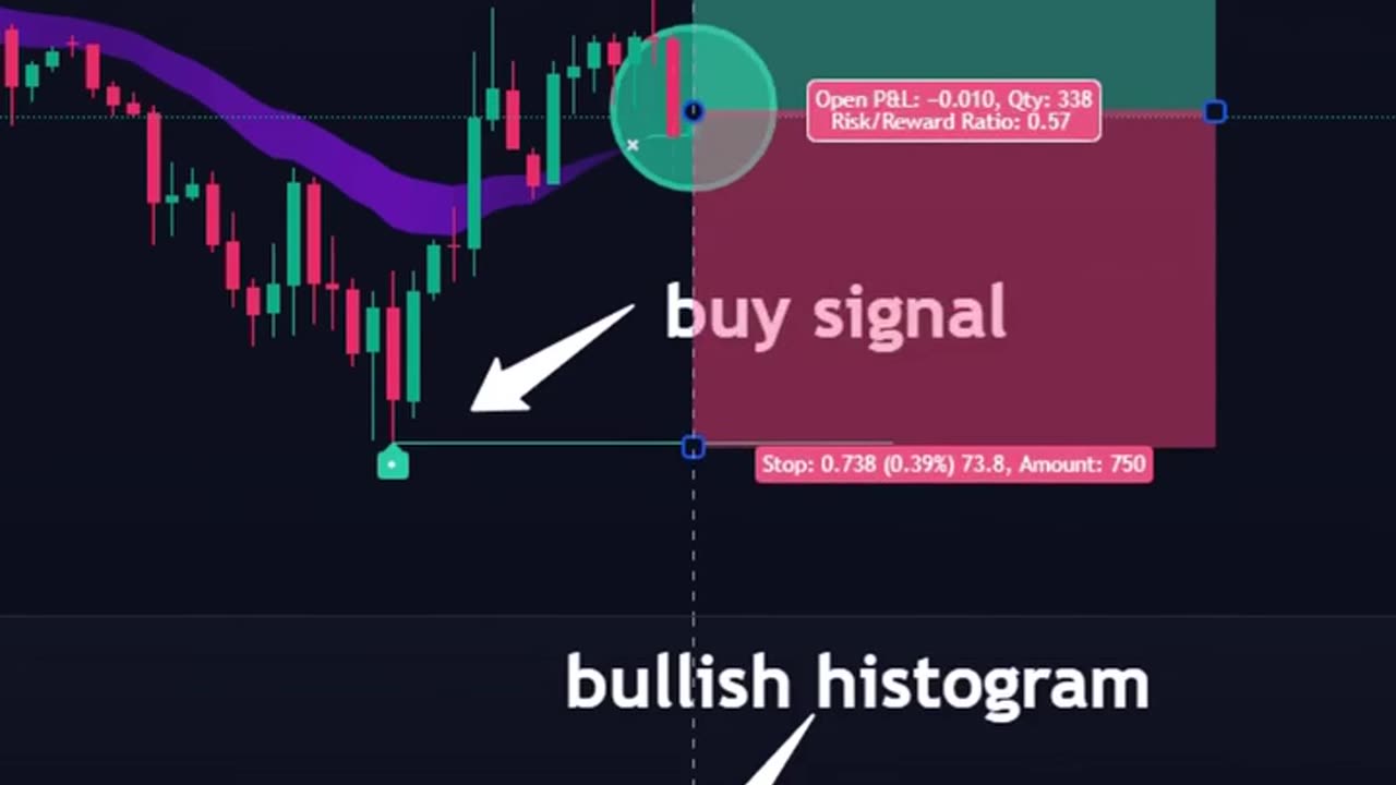 Indicators detect market trend levels🔥#daytrading