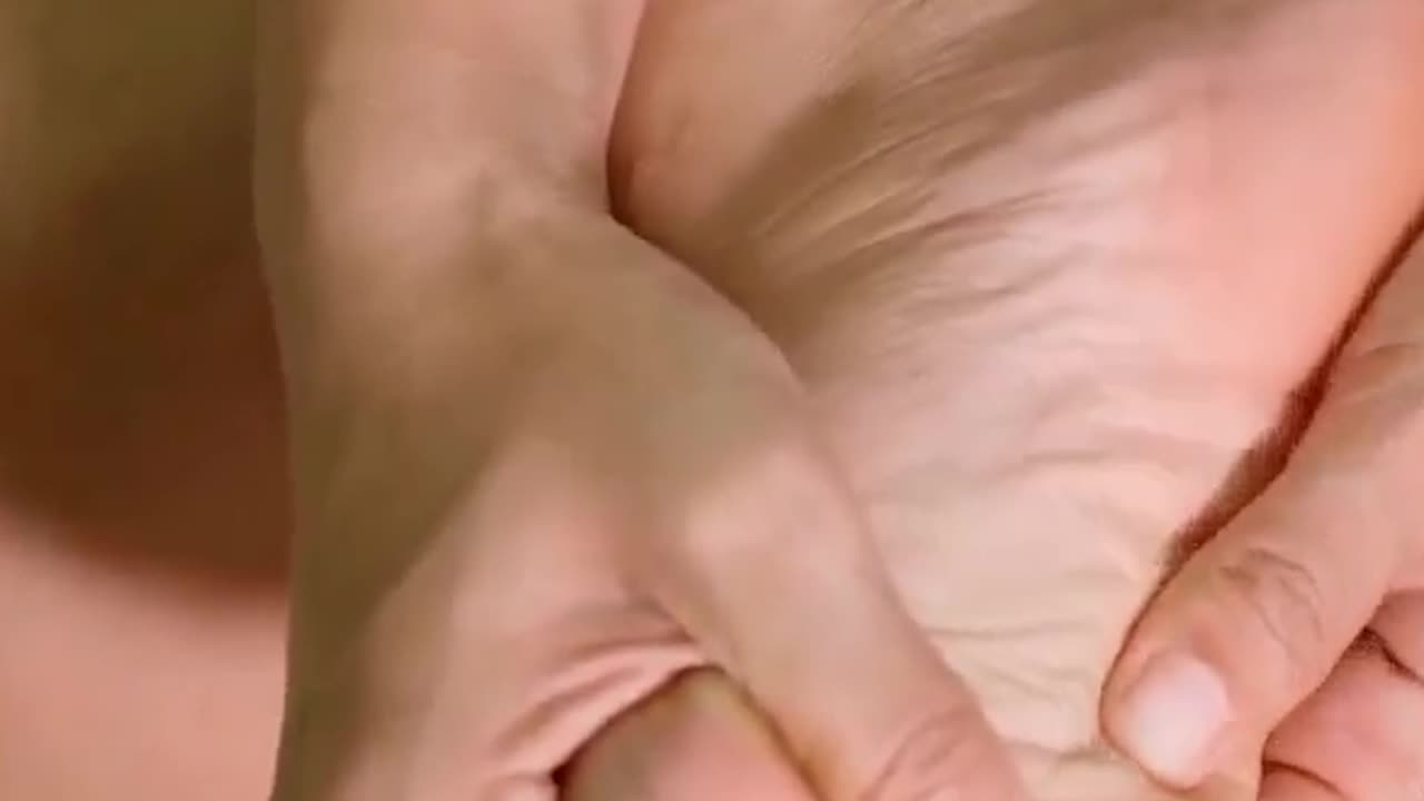 Can Boswellia Serrata Help Calm Gout?