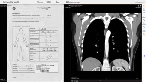 NHS X-Ray, CT & Ultrasound Medical Scan Images | NHS Patient Portal
