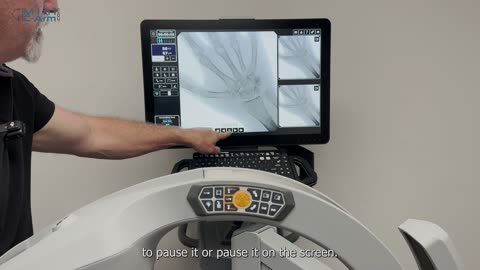 An Overview of the Orthoscan TAU 1515 Mini C-Arm | Minicarm.com