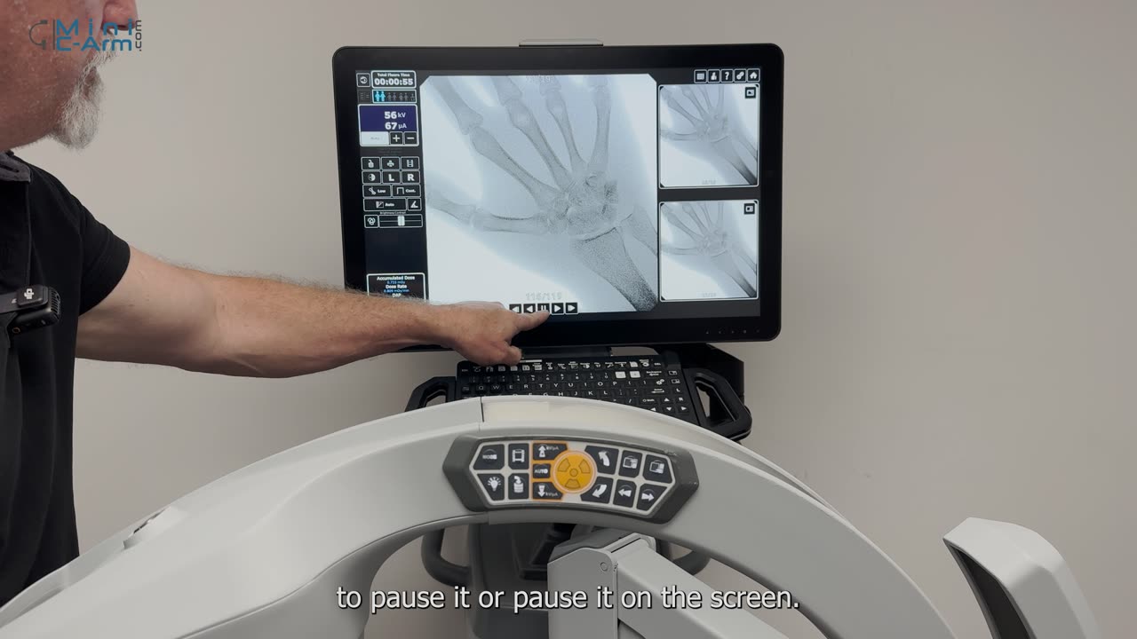 An Overview of the Orthoscan TAU 1515 Mini C-Arm | Minicarm.com