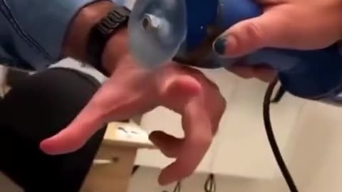 🤯🔪 Medical Saw Cuts Through Cast but Not Skin! | FeedMyCuriosity
