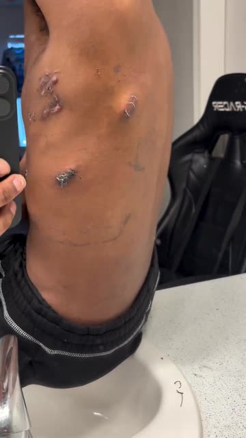 He was set up by a female and ambushed by several guys