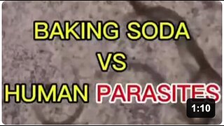 Baking Soda vs Human Parasites Known as Cancer (Under The Microscope)