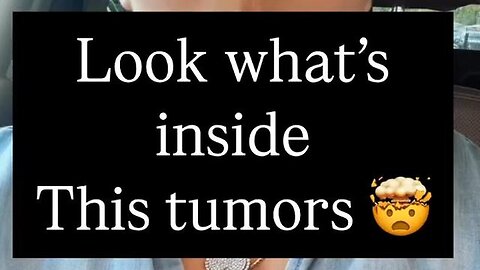 "Understanding Cancer: Exploring the Concept of Tumours as Parasites"
