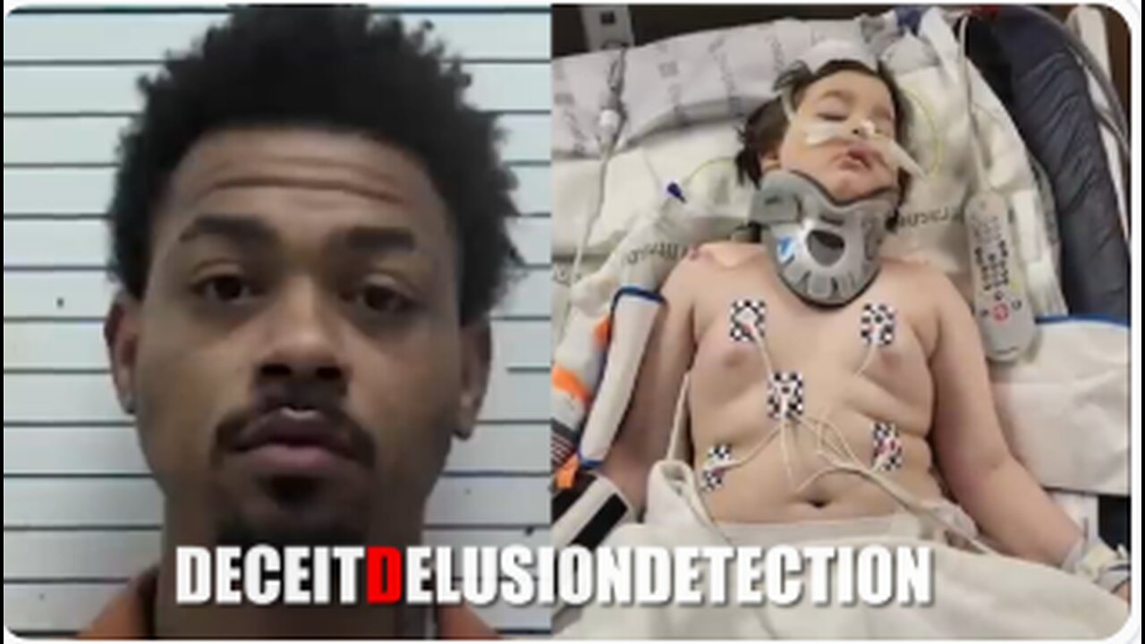 An 8-year-old white child was shot in the head by a black suspect