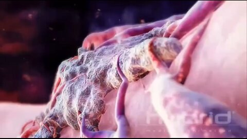 COMPLETE REMISSION of Stage IV cancers using fenbendazole. Mel Gibson was right.