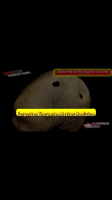 Forgotten Therapies: Myth or Medicine? #TherapeuticPractices #AncientWisdom