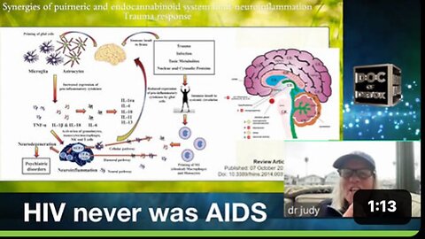 HIV never was AIDS